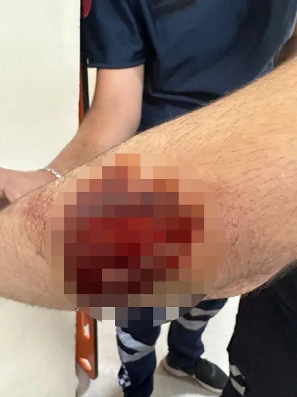 1690918446169.jpg Diyarbakır’da yol verme tartışması: 4 sağlıkçı bıçaklandı - 1