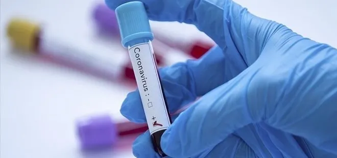 Dünya Sağlık Örgütü’nden koronavirüs uyarısı! Kovid-19’un BA.2.86 varyantı 11 ülkede tespit edildi