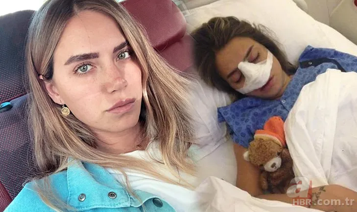 Ceyda Ateş’ten estetik itirafı! Set kazası kabusu oldu 3 kez ameliyat masasına yattı 1