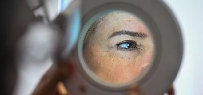 Dermatoloji uzmanı uyardı: Yazın güneş koruması şart