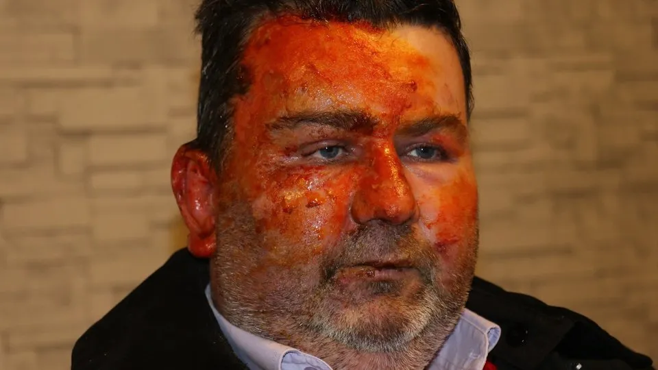 Uyurken hayatı tepetaklak oldu! Kardeşinin yüzüğünü yaktığını söyledi: Ne iyi yaptım, seni yaktım