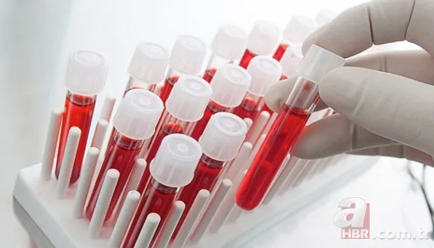 Anne babalar dikkat: Bu kan grubuna sahip çocukların zekası şahane çıkıyor! 5