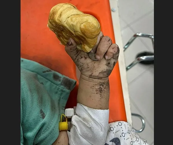 1698037388732.jpg Hastaneler mezarlığa döndü! Gazze'deki doktor Velit Abuhatab yaşanan dramı böyle anlattı: İnsanlar hastaneyi barınak olarak görüyor - 4