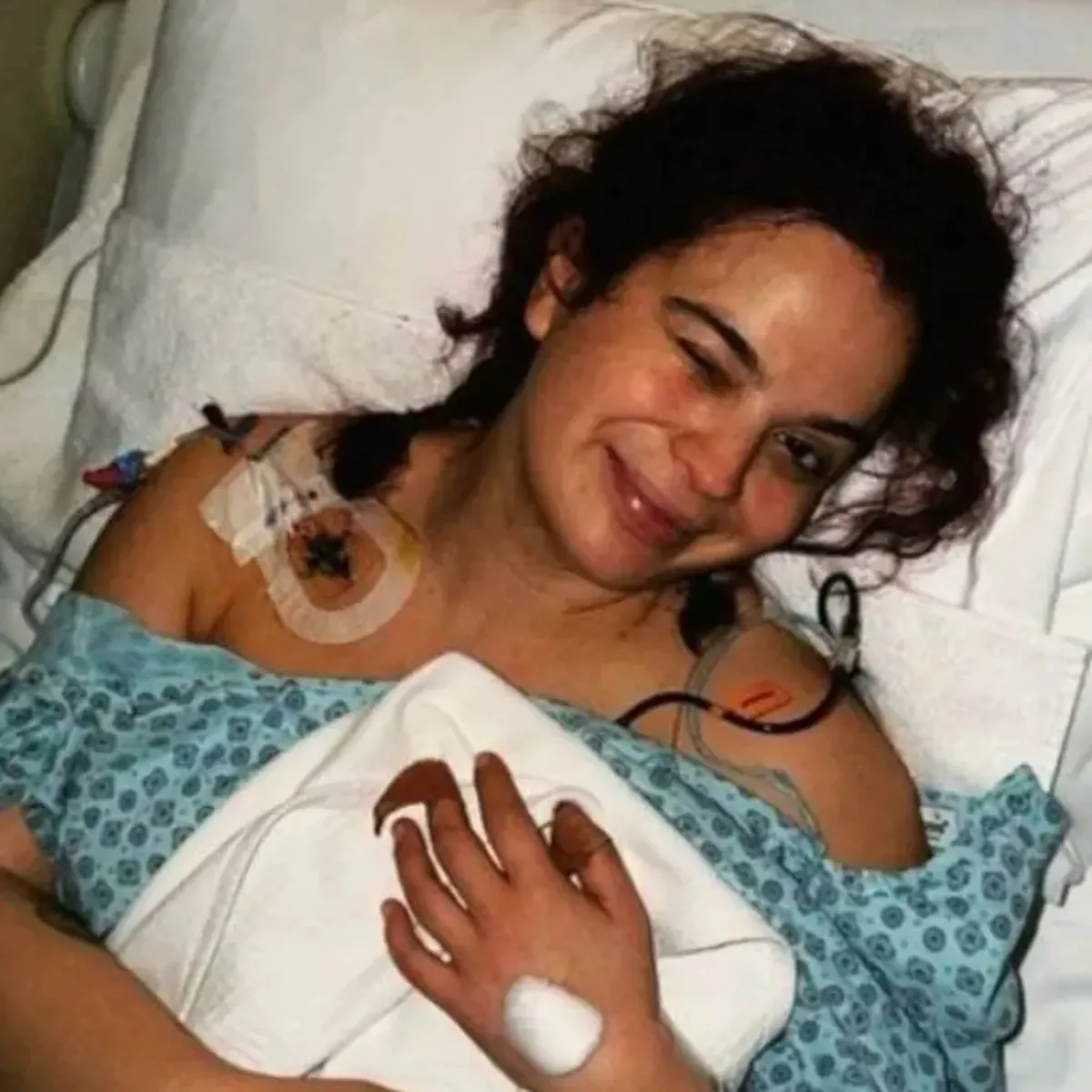 2 kez ölümden dönmüştü! Aslı Bekiroğlu 8. ameliyatını duyurdu
