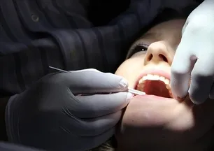 Şimdiye kadarki en kokulu sağlık sırrı! O basit sebze ağzı nasıl temizliyor?