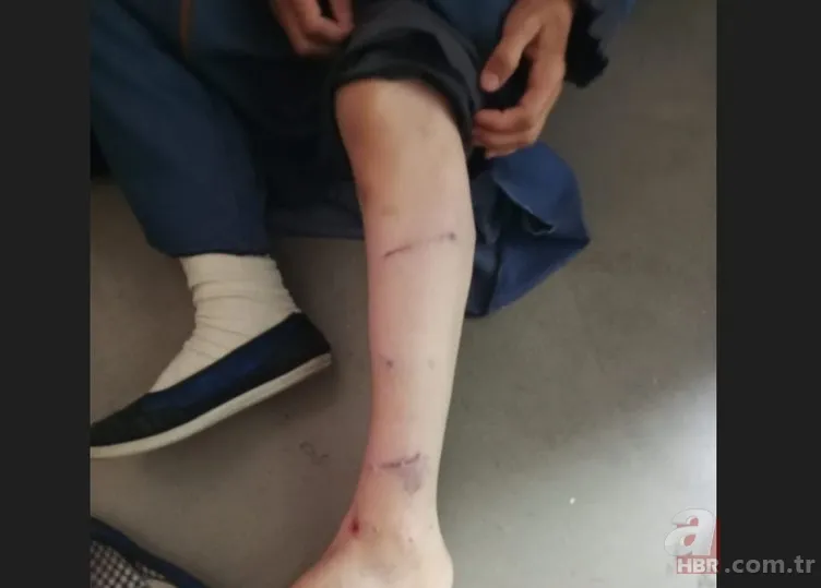 Ekrem İmamoğlu'nun danışmanı Murat Ongun'dan ısıran köpeğine koruma şikayetçi çalışana tehdit! Hem sahip çıkmadı hem işten kovdurdu 2