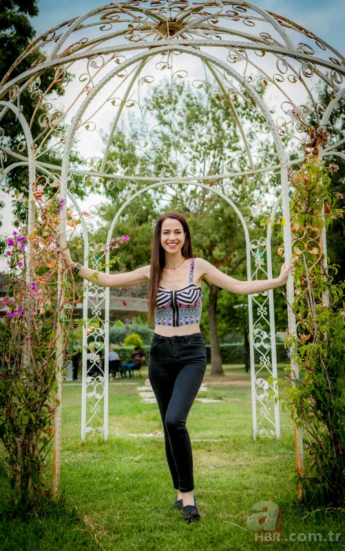 Şarkıcı ve oyuncu Zeynep Doruk dehşeti yaşadı! Köpekler saldırdı: Yüzü tanınmaz hale geldi 8