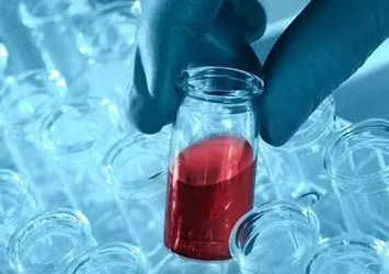 Nejat İşler'in rahatsızlığı ölüme neden olabiliyor