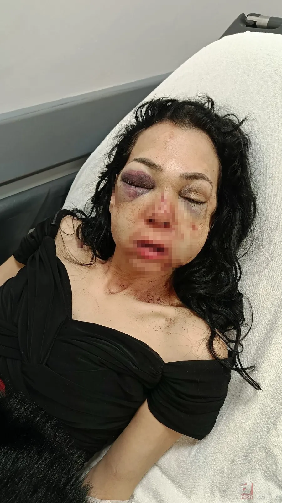 Anne ve oğlunu öldüresiye dövüp 'merdivenden düştü' dediler: Meğer ilk vukuatları değilmiş 2