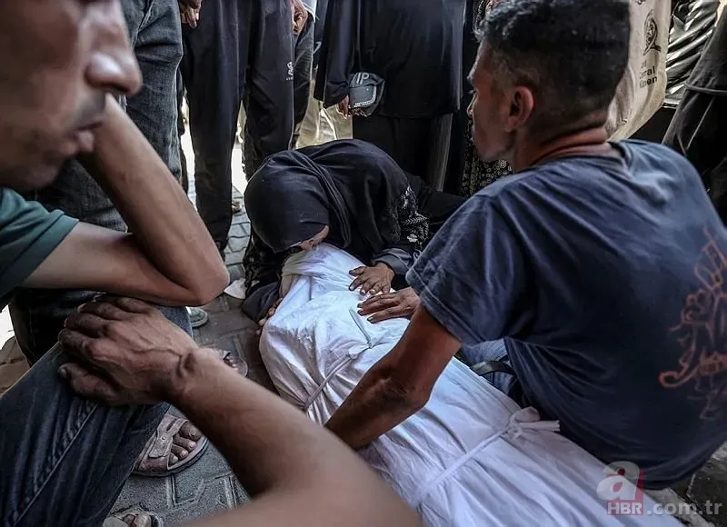 ABD'li doktor soykırımcı İsrail'in acımasızlığını herkese duyurdu: Karnından ve göğsünden vurulmuş çocuklar gördüm 22