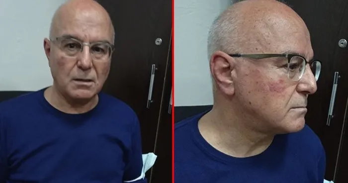 Balıkesir’de kabus dolu anlar! "Karınız değil eşiniz diyeceksin" diyerek Doktor Hüseyin Kara'ya saldırdı - 2