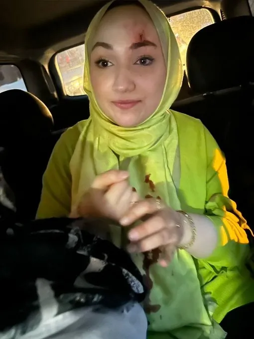 İzmir’de Erdoğan’ın seçim zaferini kutlayan genç kıza taşlı saldırı! Alnı kanayan genç kız hastaneye götürüldü...