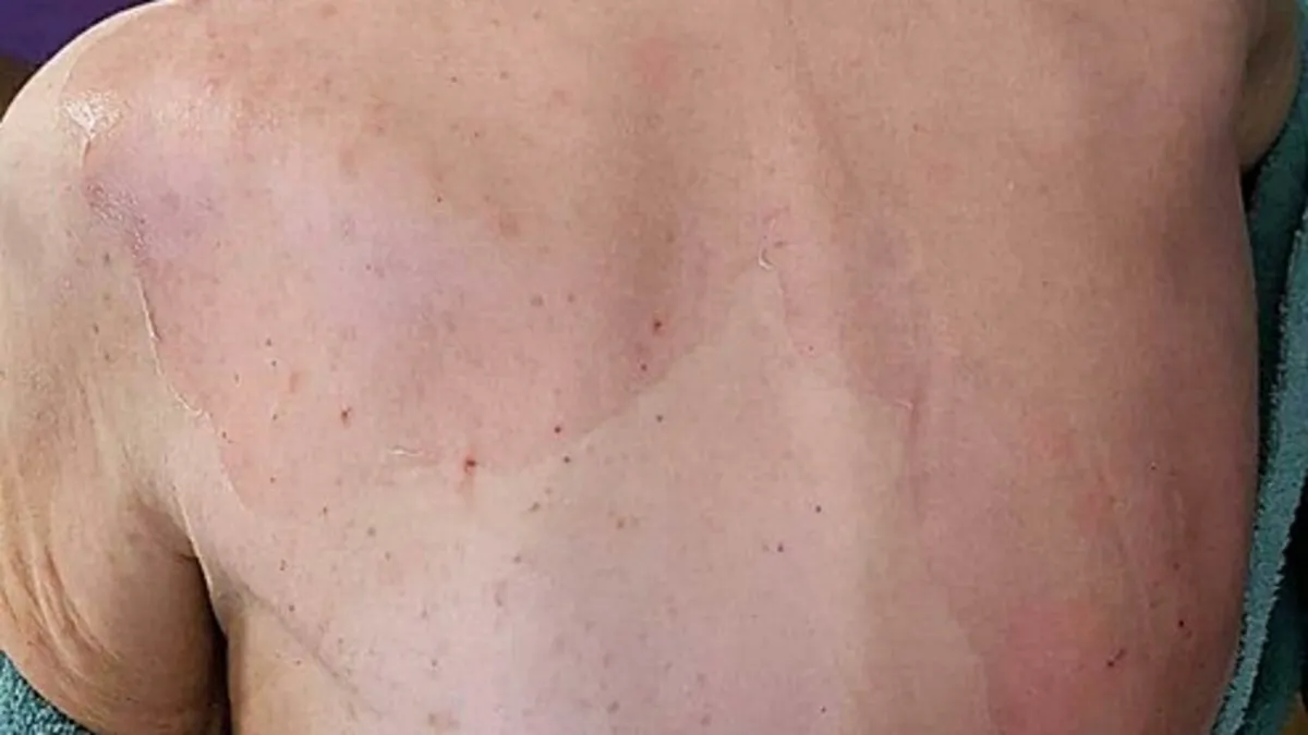 İzmir'de huzurevinde ölüm olayında doktor hakkında yakalama kararı