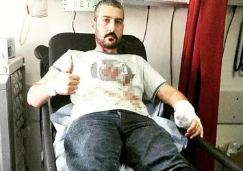 Vatan uğruna 6 yıldır şarapnel parçalarıyla yaşıyor! 15 Temmuz'da yaşadıklarını anlattı