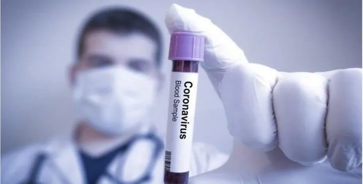 Corona virüs koronavirüs testi hangi hastanelerde ücretsiz? Sağlık Bakanlığı liste yayınladı