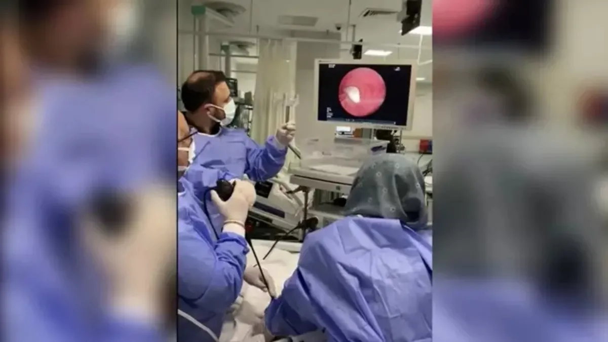 Hastanın akciğerine kaçan sarımsak operasyonla çıkarıldı