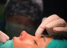 Güzelleşmek isterken estetik kurbanı olmayın