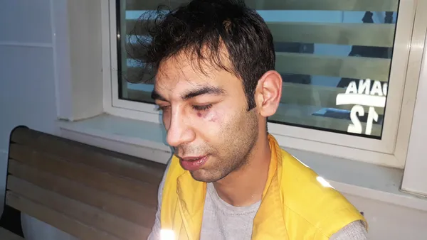 Ölen köpeği hastaneye götürmeyen 112 ekibi darbedildi - 1