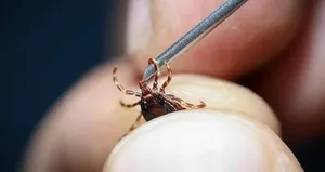 Uzmanından kene vakalarında doğru müdahale uyarısı