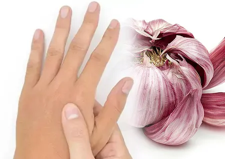 Koreliler böyle iyileşiyor! Sarımsağı parmaklarına sarıp bekleyin...