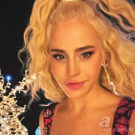 Büşra Pekin’de estetikle yeni birine dönüşenler kervanında! 1 estetiğim var deyince ti’ye alınmıştı… 4 bantla o hale gelmiş! 16