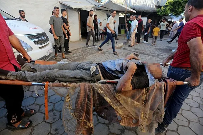 siyonist-israilde-katliam-devam-ediyor-en-az-8-kisi-oldu-1723791177141.jpeg Saldırıda yaralanan Filistinli ve onu taşıyan insanlar