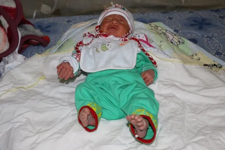 Suriyeli bebek ’24 parmaklı’ doğdu