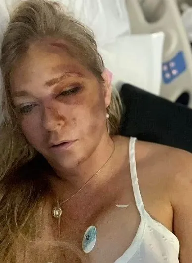 Epstein skandalının ilk kurbanlarından Virginia Giuffre inithar etti!
