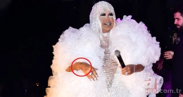 Bülent Ersoy'a ne oldu? Bülent Ersoy moraran elleriyle sevenlerini korkuttu 2