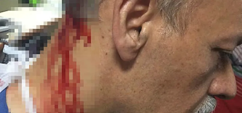 Elazığ’da akılalmaz olay! 'Araba çarptı' diye ihbarda bulundu, hastanede doktora yumruk attı