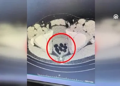 Midesinden çıktı! Gözaltına alındı