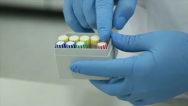 Türk bilim insanları koronavirüs tanısı için yeni sistem geliştirdi - 4