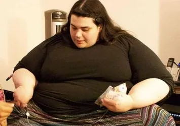 300 kiloya ulaşmıştı! Son hali şaşırttı