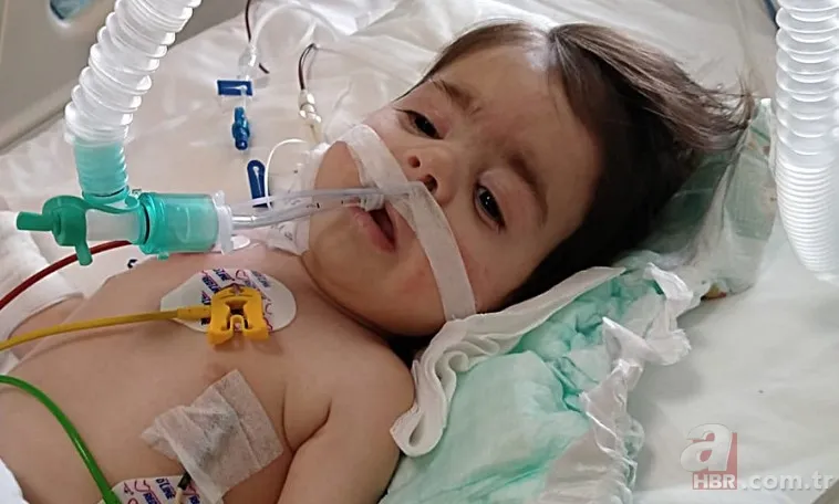 SMA hastalığı nedir, ne zaman ortaya çıkar? SMA teşhisi nasıl konur? Tedavisi, belirtileri, SMA testi... 12