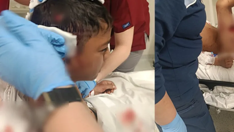 Başıboş köpek terörü! Küçük çocuğa saldırdılar hastanelik oldu: Çocuğu paramparça ettiler