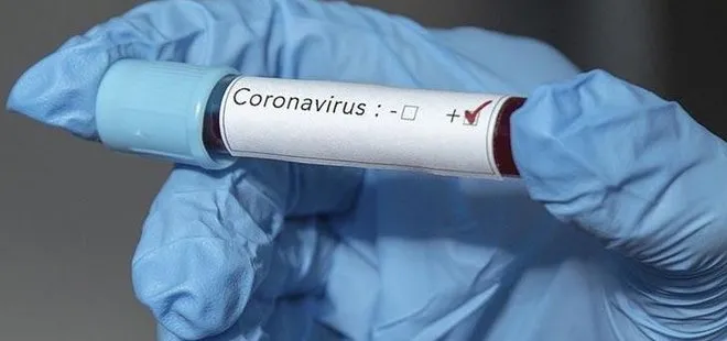 Tek amaçları aşı geliştirip koronavirüsü yenmek!