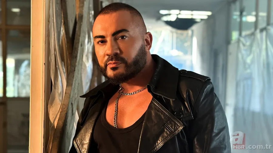 Rober Hatemo'nun son görüntüsü olay oldu! Yüzüne bakın ne yaptırmış! 'Yenilendim' 1