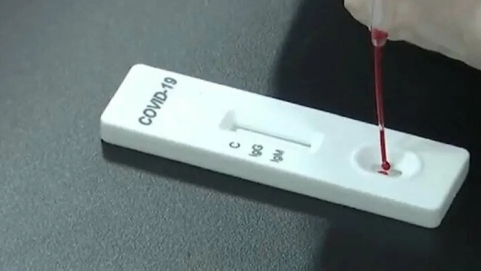 Ödüllü test kiti büyük kolaylık sağlayacak! Artık evlerde tespit edilebilecek