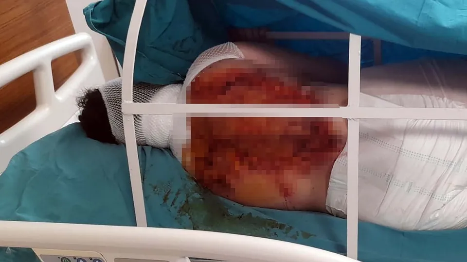 Üvey annesine kezzapla saldırdı! Nedeni ise dehşete düşürdü