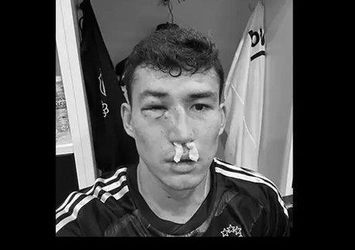 Beşiktaş'ta korkutan sakatlık! Zaynutdinov hastaneye kaldırıldı