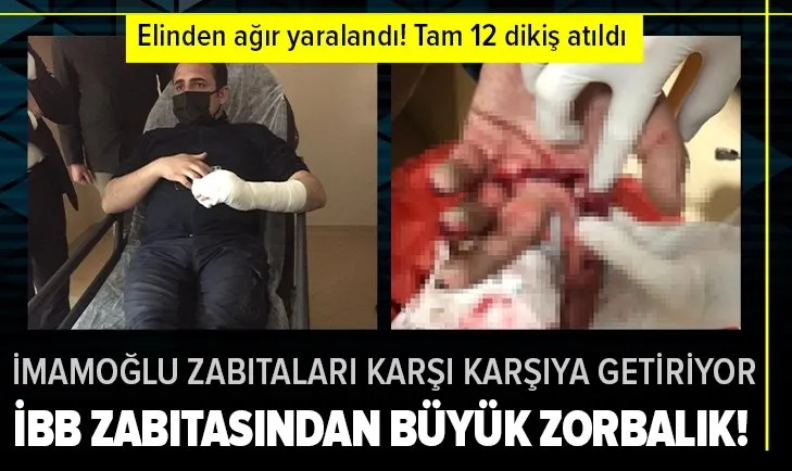 İBB zabıtalarından büyük zorbalık! Ümraniye Belediyesi zabıta memuru Mustafa Sungur Polat’ın eli yarıldı