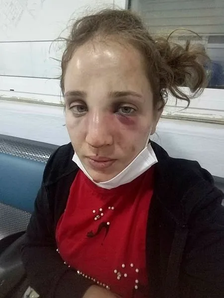 Aydın'da işkenceci koca 3 çocuğunun annesini bu hale getirdi - 2