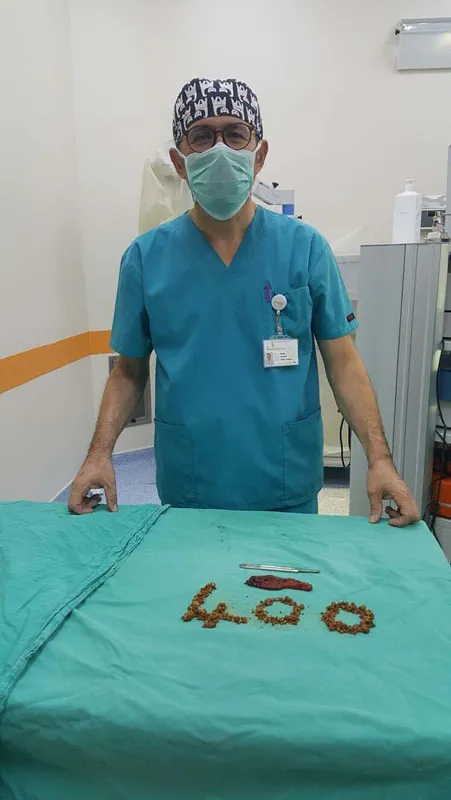 23 yaşındaki gencin safra kesesinden 400 taş çıkarıldı - 2