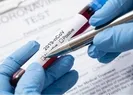 O ülkede evden çıkabilmek için test şartı getirildi