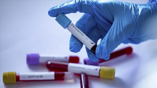 Türkiye'de üretilen koronavirüs testi dünyada bir ilk olacak - 3