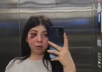 Sokak ortasında kabusu yaşadı! Korku dolu anları anlattı: Uyuyamıyor yemek yiyemiyorum