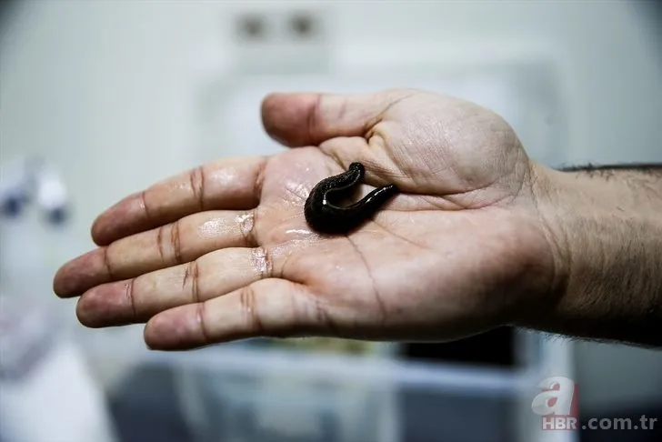 Sülüklerin nesli tükenme tehlikesiyle karşı karşıya! Uzmanlar uyardı… 2