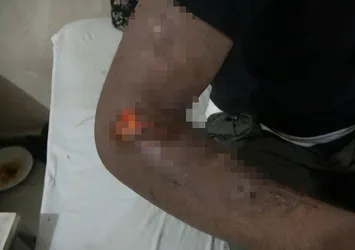 Yunan askerleri Pakistanlı göçmenlere işkence uyguladı! Önce tırnaklarını çektirler ardından...