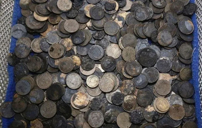 Midesinden 915 adet bozuk para çıktı - 1
