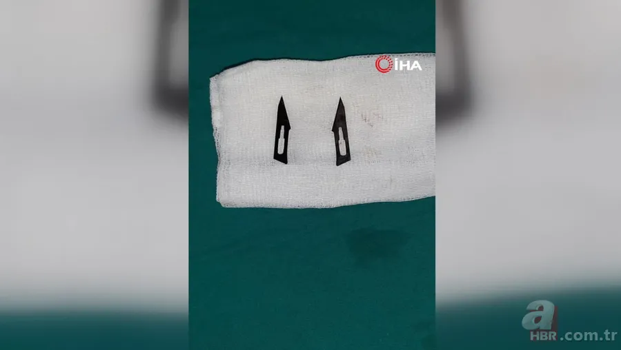 Amasya’da 22 yaşındaki genç kız karın ağrısı şikayetiyle hastaneye gitti! Gerçek şoke etti: Tam 5 kilo 18